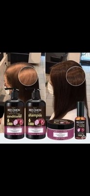 Red  Onion Hair Traitment Set :  Shampoo, Conditioner, hair Mask set  16.9oz