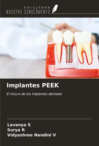 Lavanya S (U. A.) | Implantes Peek | Taschenbuch | Spanisch (2023)-image