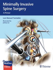 Minimally Invasive Spine Surgery Luis Manuel ...