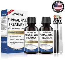 Fungus Treatment For Toenail, 25 Undecylenic Acid, Ingrown Nail repair Strength