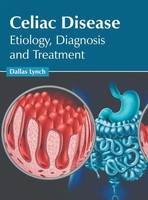 Celiac Disease | Etiology, Diagnosis And Treatment | Dallas Lynch | Buch | 2023