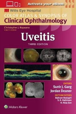 Uveitis ~ Sunir J. Garg ~  9781975215194