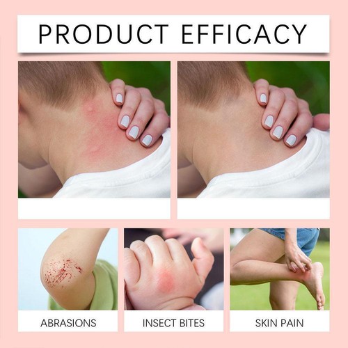 Naturals PRID Drawing Salve Topical Skin Irritation Relief For Splinters New - Picture 15 of 17