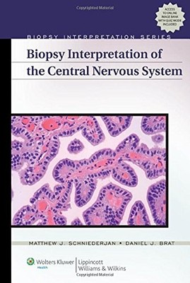Biopsy Interpretation of the Central Nervous System   by Matthew J. Schniederjan