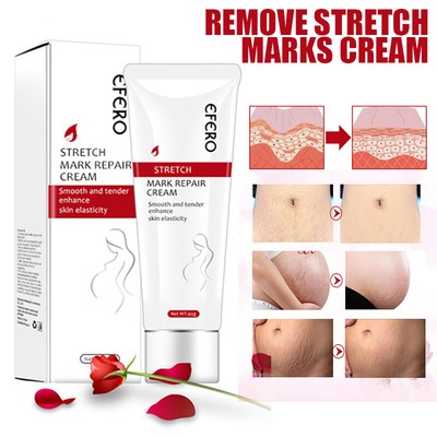 efero stretch mark cream