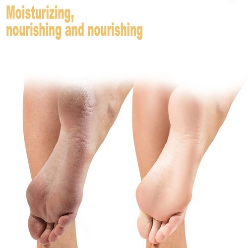 200ml Foot Exfoliation Spray Repair Dead Skin and Calluses Whitening Care X5D1 - 第 10/14 張圖片