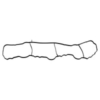 Febi Dichtung Mercedes 102391