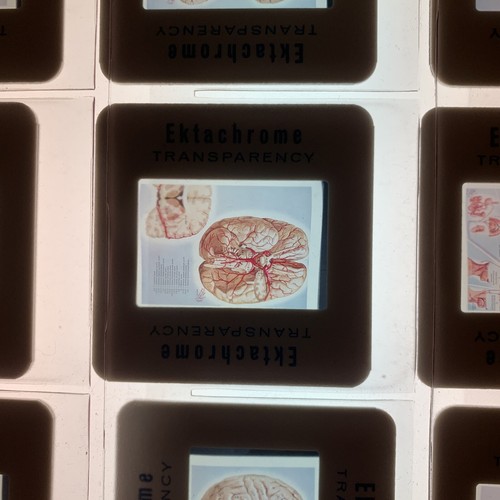 Vintage Medical Slides - Picture 13 of 19