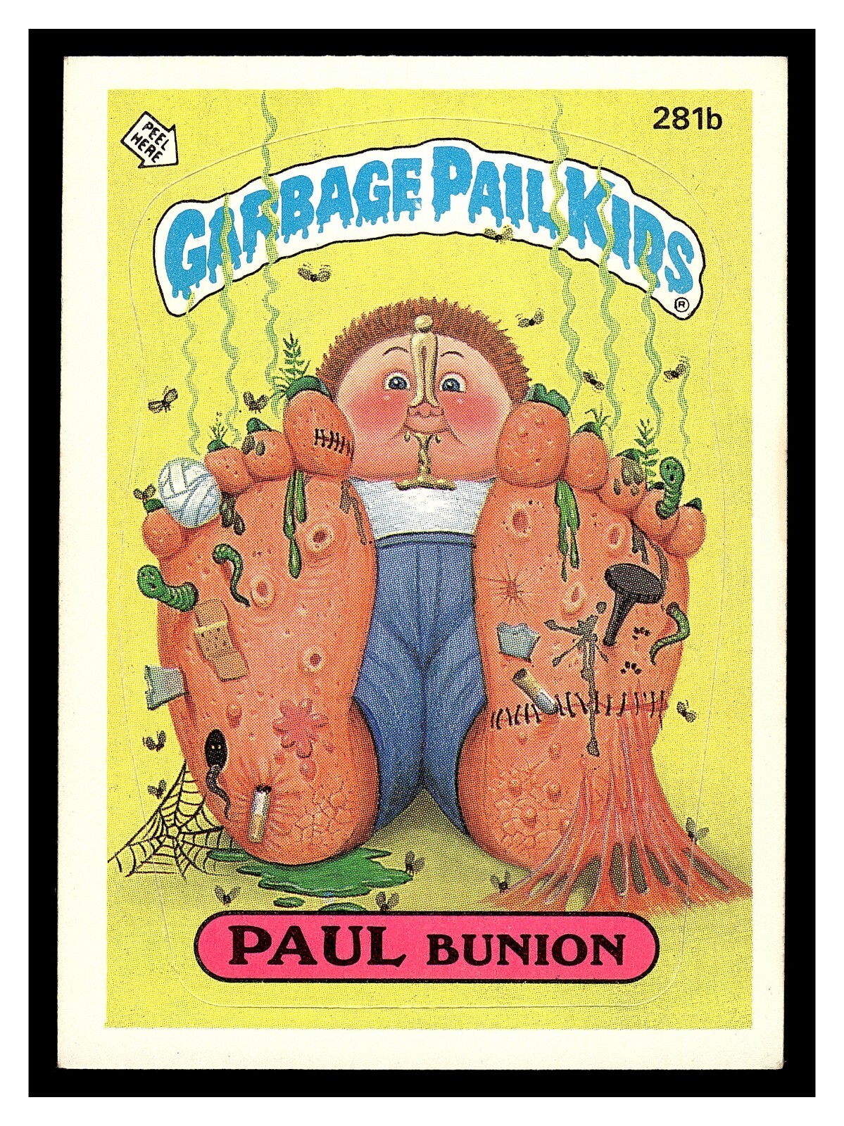 PAUL BUNION #281B GARBAGE PAIL KIDS GPK ORIGINAL SERIES 7 OS7 HIGH GRADE 1987