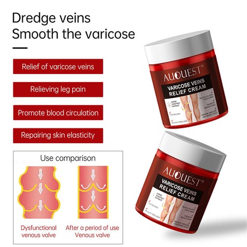 Crema de eliminación de venas varicosas tratamiento antiaraña estrías vasculitis - Imagen 8 de 9