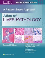 Atlas Of Liver Pathology | A Pattern-Based Approach | Torbenson (U. A.) | Buch