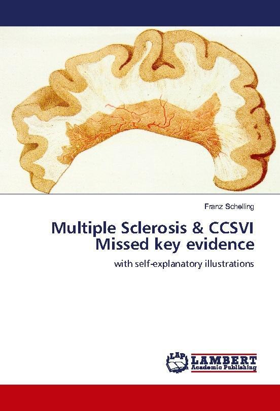 Multiple Sclerosis & Ccsvi Missed Key Evidence Franz Schelling