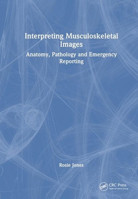 Interpreting Musculoskeletal Images: Anatomy, Pathology and Emergency Reporting 