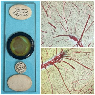Antique Microscope Slide . Injected Brain Of Rabbit . By Watson.