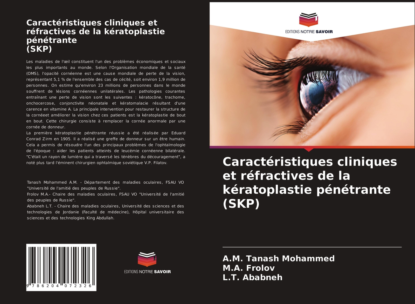 Thumbnail - Caractéristiques Cliniques Et Réfractives De La Kératoplastie