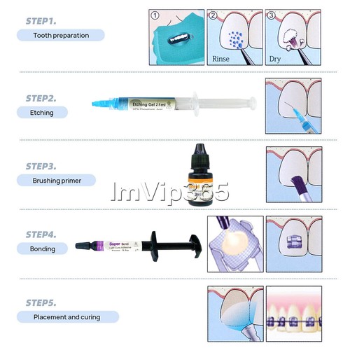 Dental Brackets /Orthodontic Light Cure Adhesive Kit/Blue Green Glue/Mini No-Mix - Picture 37 of 47