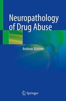 Neuropathology Of Drug Abuse Andreas BüTtner