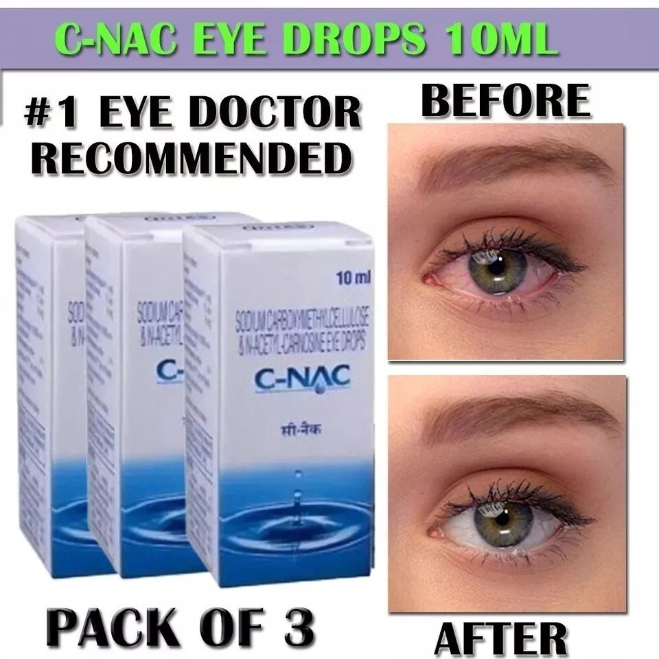 For Cataracts 10ml - Pack Of 3