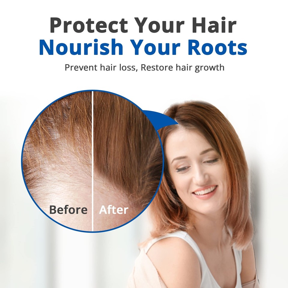 Natural Hair Growth Serum - ulo.co