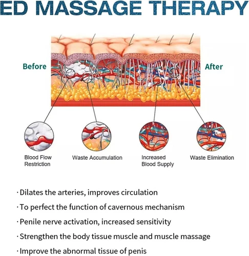 ED Shockwave Therapy Machine terapia con onde d'urto professionali ED extracorporee - Foto 10 di 23