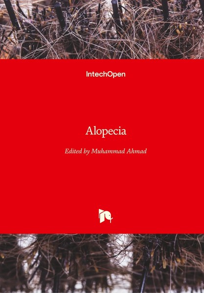 Muhammad Ahmad | Alopecia | Buch | Englisch (2018) | 148 S. | Intechopen-image