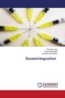 Shubham Jain (U. A.) | Osseointegration | Taschenbuch | Englisch (2021)