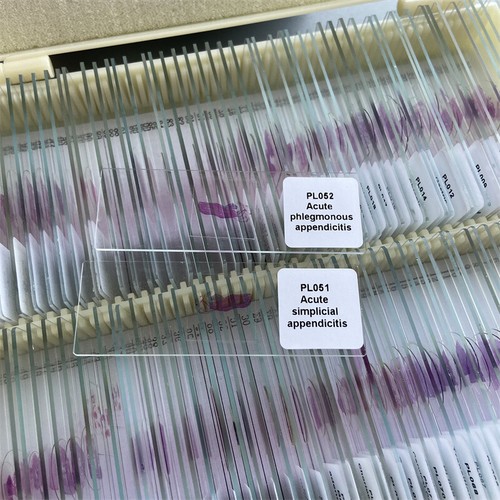 100 PCS Menschlicher pathologischer Schnitt Typische präparierte Gewebeprobenrut - Bild 5 von 12