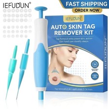 Auto Micro Skin Tag Remover Device Kit Safe Painless Removal 2-8 mm Band Tool