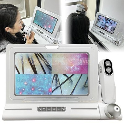 1pc Hair Diagnosis Analyzer Hair Scalp Hair Follicle Detector 50X 200X Dual Lens