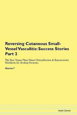 Reversing Cutaneous Small-Vessel Vasculitis, ,  Pa