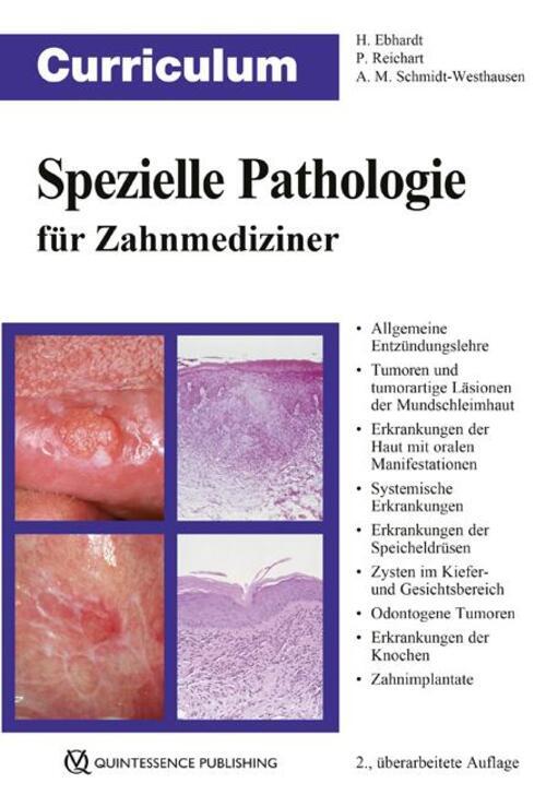 Thumbnail - Curriculum Spezielle Pathologie Für Zahnmediziner Harald Ebhardt (u.