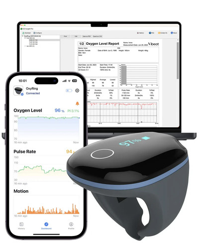 Vibeat OxyRing Continuous Oxygen Monitor - Bluetooth Pulse Oximeter-NEWOPENBOX