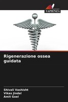 Shivali Vashisht (U. A.) | Rigenerazione Ossea Guidata | Taschenbuch (2023)