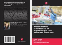 Procedimentos Laboratoriais De Implantologia Para Pacientes EdêNtulos Buch 2024