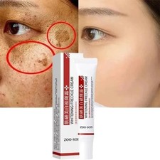 Powerful Spot-removing Whiten Cream Pigmentation Melasma Dark Spots UK