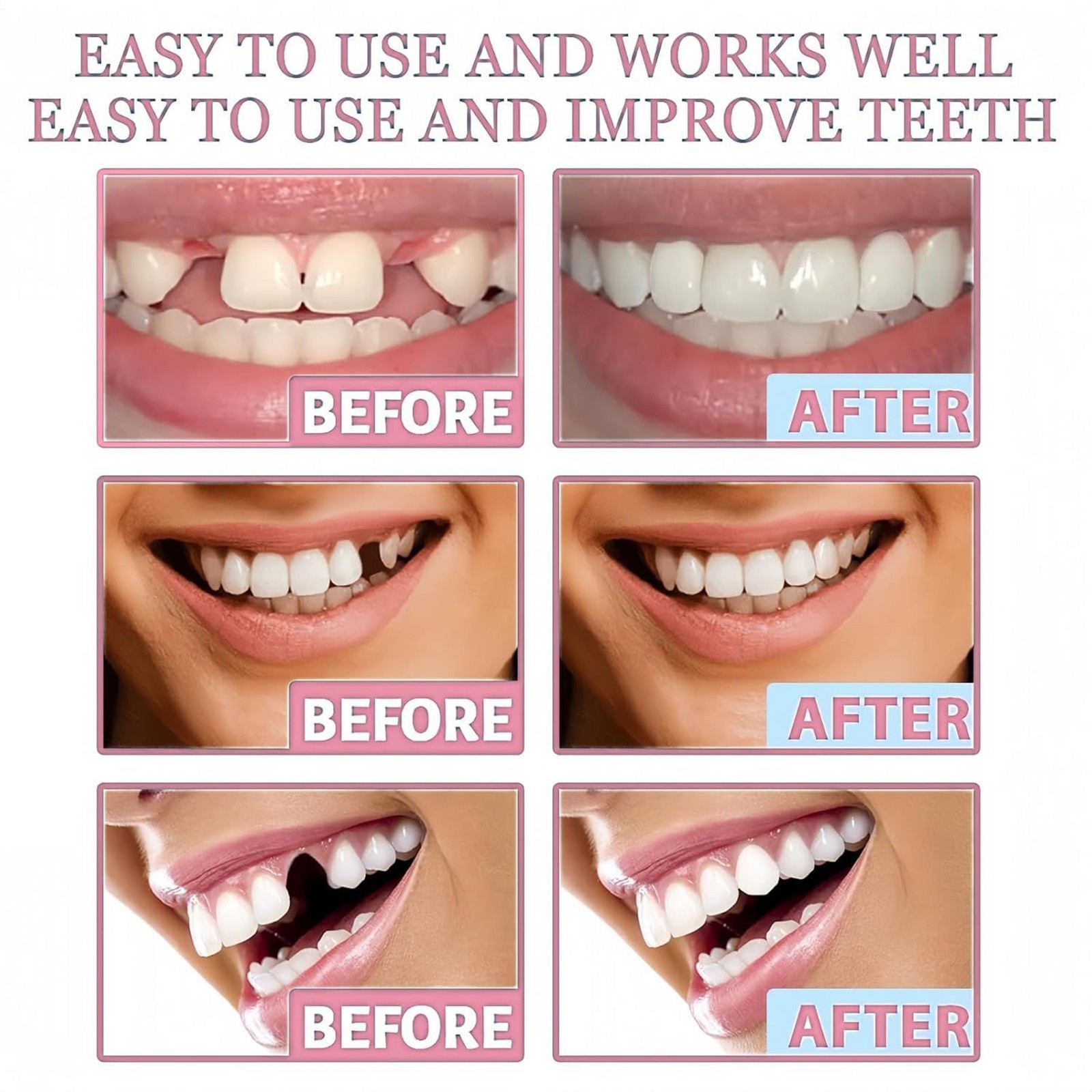 Denture Adhesive Max Hold Thermoplastic Denture Cushion Repair Glue Sealant 20g