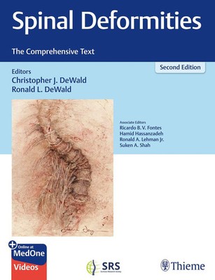 Christopher Dewald (u. a.) | Spinal Deformities | Buch | Englisch (2025)