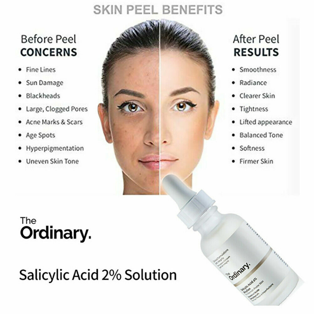 ordinary skin peel