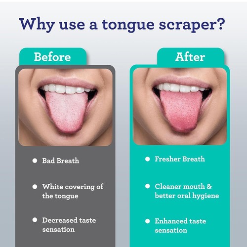 2pcs Tongue Scraper Adults Travel Case 420 Medical-Grade 100% Stainless Steel - Picture 5 of 11