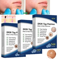 720pc Skin Tag Remover Patches Quick Effective Mole and Wart Pad Removal Sticker
