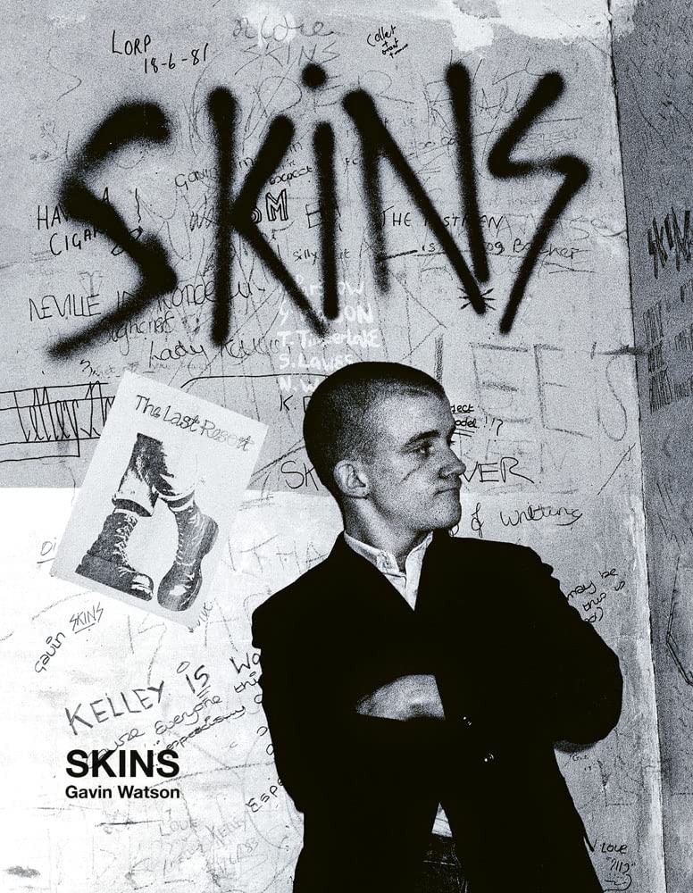 Skins Gavin Watson by Gavin Watson (Hardback Book) - Image 7