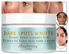 Even tone skin freckle speckle peels dark spot face facial skin white cream