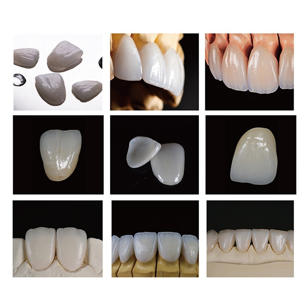 5 Piezas C14 Bloqu De Disilicato De Litio Cerec E-max Cubos De - Foto 2
