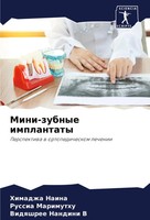 Himadzha Naina (U. A.) | Mini-Zubnye Implantaty | Taschenbuch | Russisch (2023)
