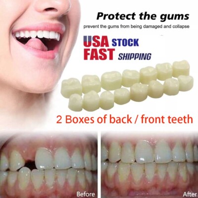 2 Boxes Resin Anterior Dental Temporary Porcelain Crown Veneers Stable Teeth US