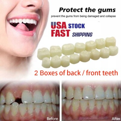 #ad 2 Boxes Resin Anterior Dental Temporary Porcelain Crown Veneers Stable Teeth US $10.48