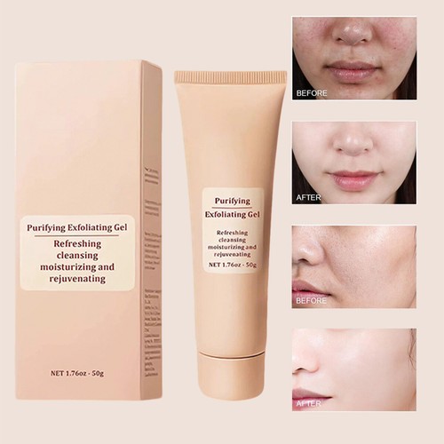 Quarxery Purifying Exfoliating Gel,Quarxery Purifying Cream, for Face & Body 50g - Picture 7 of 13