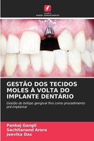 GestÃO Dos Tecidos Moles À Volta Do Implante DentÁRio Pankaj Gangil