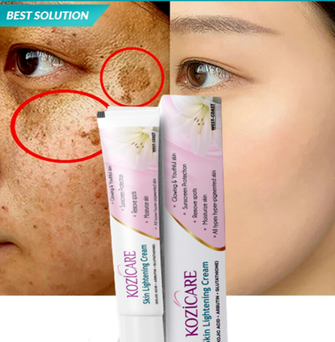 glutathione whitening side effects Trendyfave Glutathione Collagen Glow Kojic Acid Serum Vitamin C Serum For  Face Reduce Dark Spot Shrink Pores & Improve Skin Tone Glutathione Face  Serum 30ml 1 main image 0