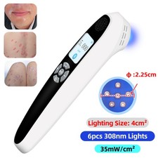 308nm UVB Ultraviolet Phototherapy Device 6 Diodes for Face Arm Skin Disorder